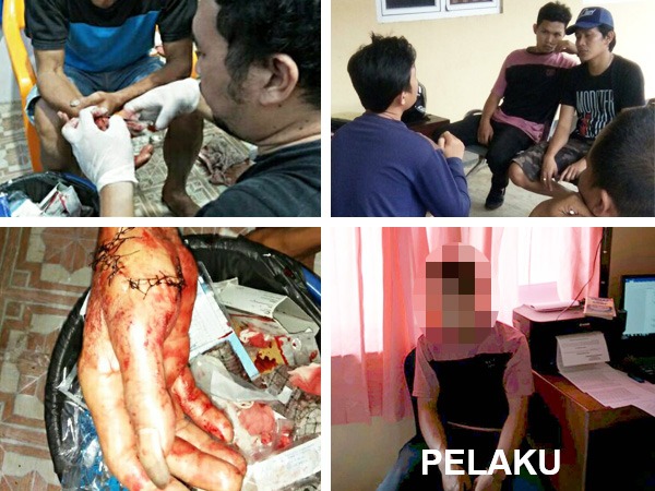 Tidak Terima Ditegur, Anggota Komplotan Balap Liar Bacok Warga Hulu Palik